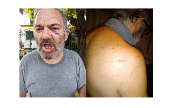 F. Varela: Salvaje golpiza a un socio del Fortín La Tropilla